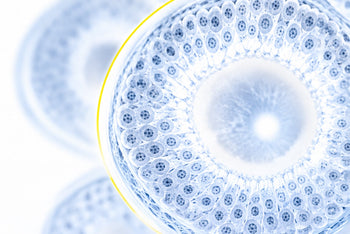 Sertoli Cell Only Syndrome: Causes and Treatments